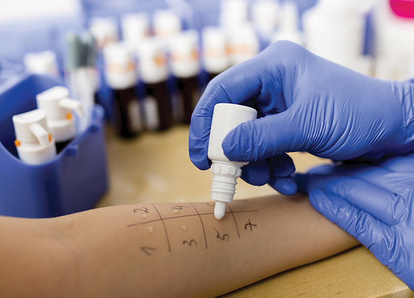 Bedside tests in dermatology Dermatology in practice